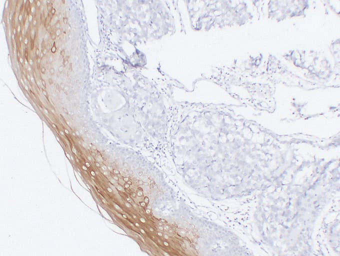 KRT4 / CK4 / Cytokeratin 4 Antibody (clone ABT-CK4)