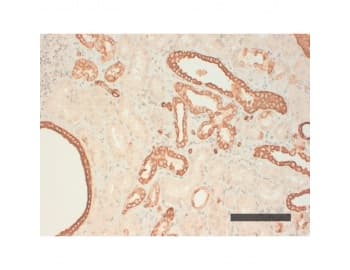 Acidic Cytokeratin AE1 Antibody (clone AE1)