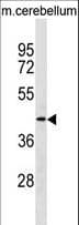 Polyclonal Rabbit anti-Human TMOD2 / Tropomodulin 2 Antibody (aa32-58, WB)