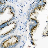 PMM2 Antibody