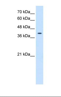 TSPAN12 Antibody (aa185-234)