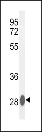 Polyclonal Rabbit anti-Human CA3 / Carbonic Anhydrase III Antibody (aa146-177, IHC, WB)