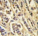 KDR / VEGFR2 / FLK1 Antibody