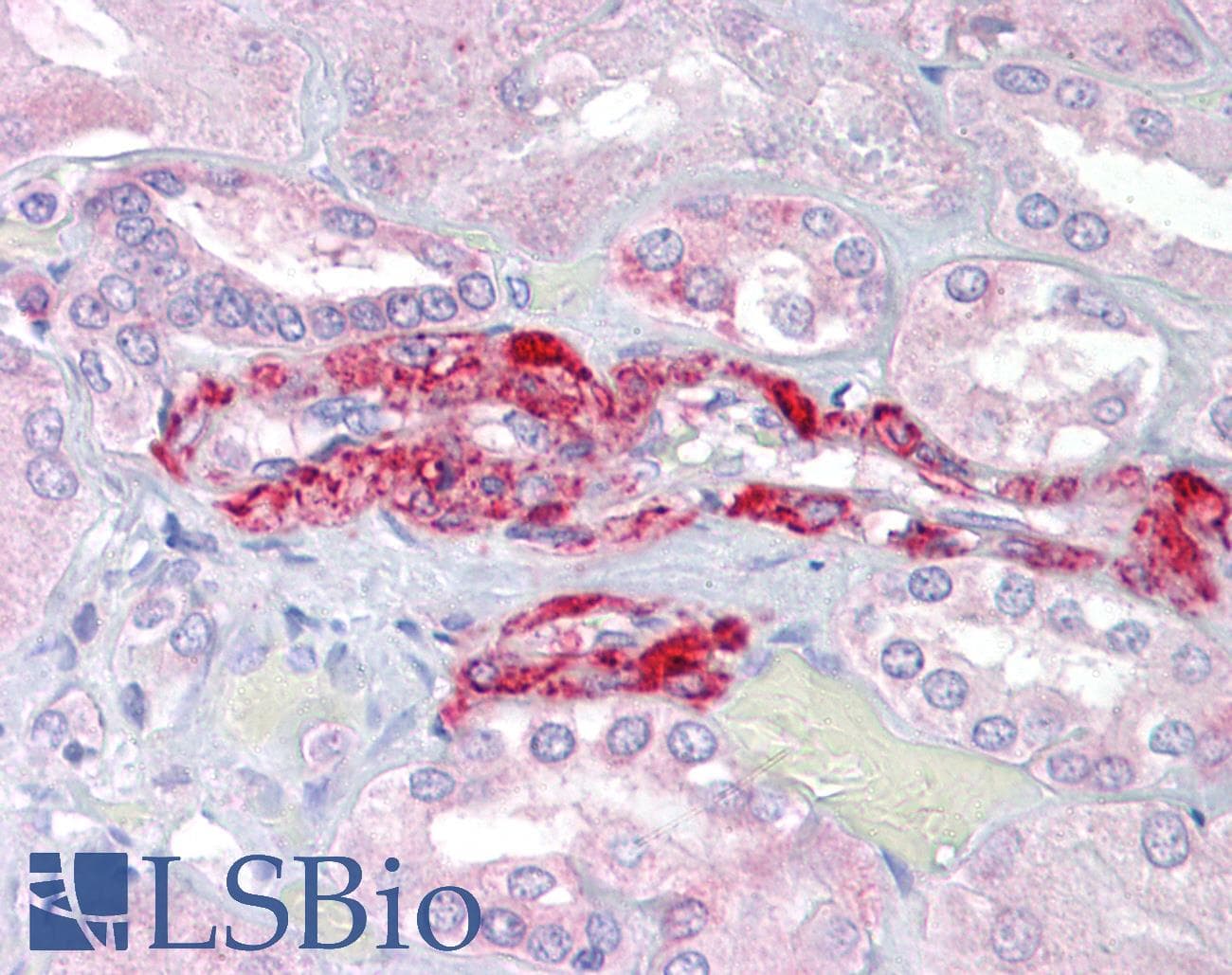 IHC-plus™ Polyclonal Rabbit anti-Human SLC39A14 / ZIP14 Antibody (IHC, IF, WB)