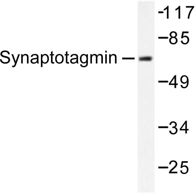 SYT1 / Synaptotagmin Antibody (Thr196)
