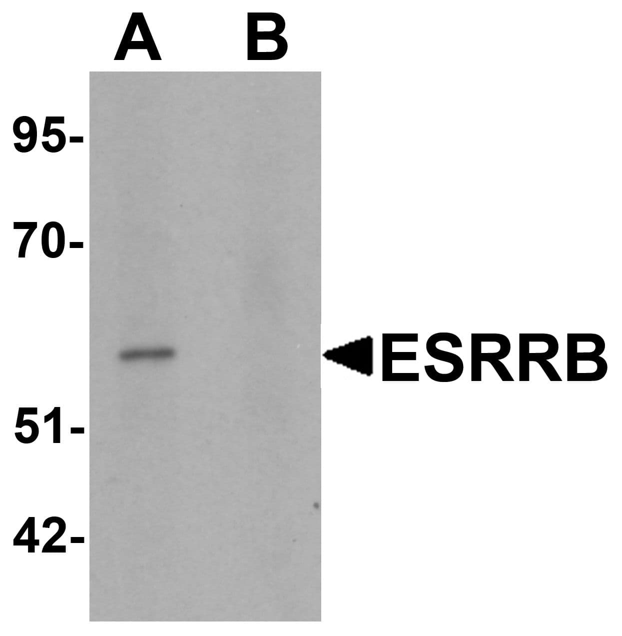Polyclonal Rabbit anti-Human ESRRB / ERR Beta Antibody (IHC, IF, WB)
