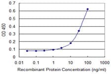 Monoclonal Mouse anti-Human P5CDH / ALDH4A1 Antibody (clone 1A12-A5, IHC, WB)