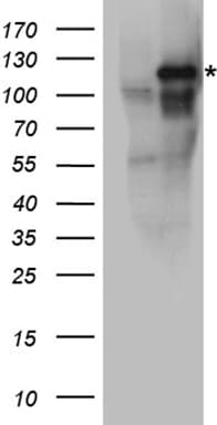EPHA3 / EPH Receptor A3 Antibody
