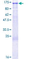 Human DAXX Protein (Recombinant GST)