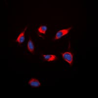 Polyclonal Rabbit anti-Human KDR / VEGFR2 / FLK1 Antibody (Internal, IHC, IF, WB)