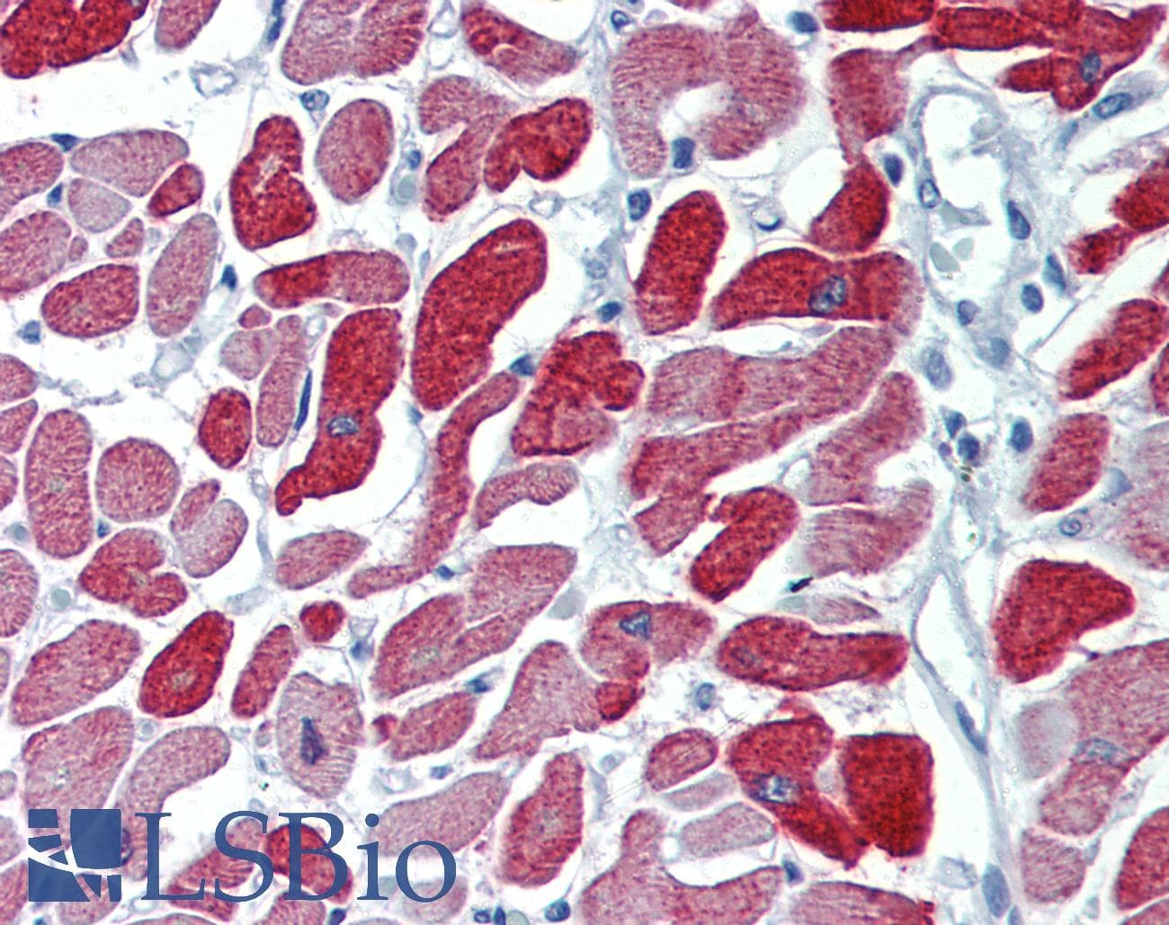 IHC-plus™ METTL7B Antibody