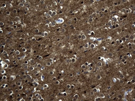 Monoclonal Mouse anti-Human MAPT / Tau Antibody (clone UMAB239, aa623-758, IHC, WB)