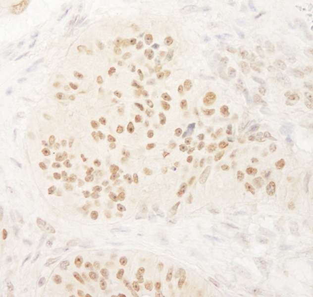 HSET / KIFC1 Antibody (aa625-673)