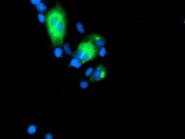 GOLM1 / GP73 / GOLPH2 Antibody (clone OTI2D6)
