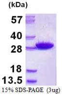 Human GSTM5-5 / GSTM5 Protein (Recombinant His)