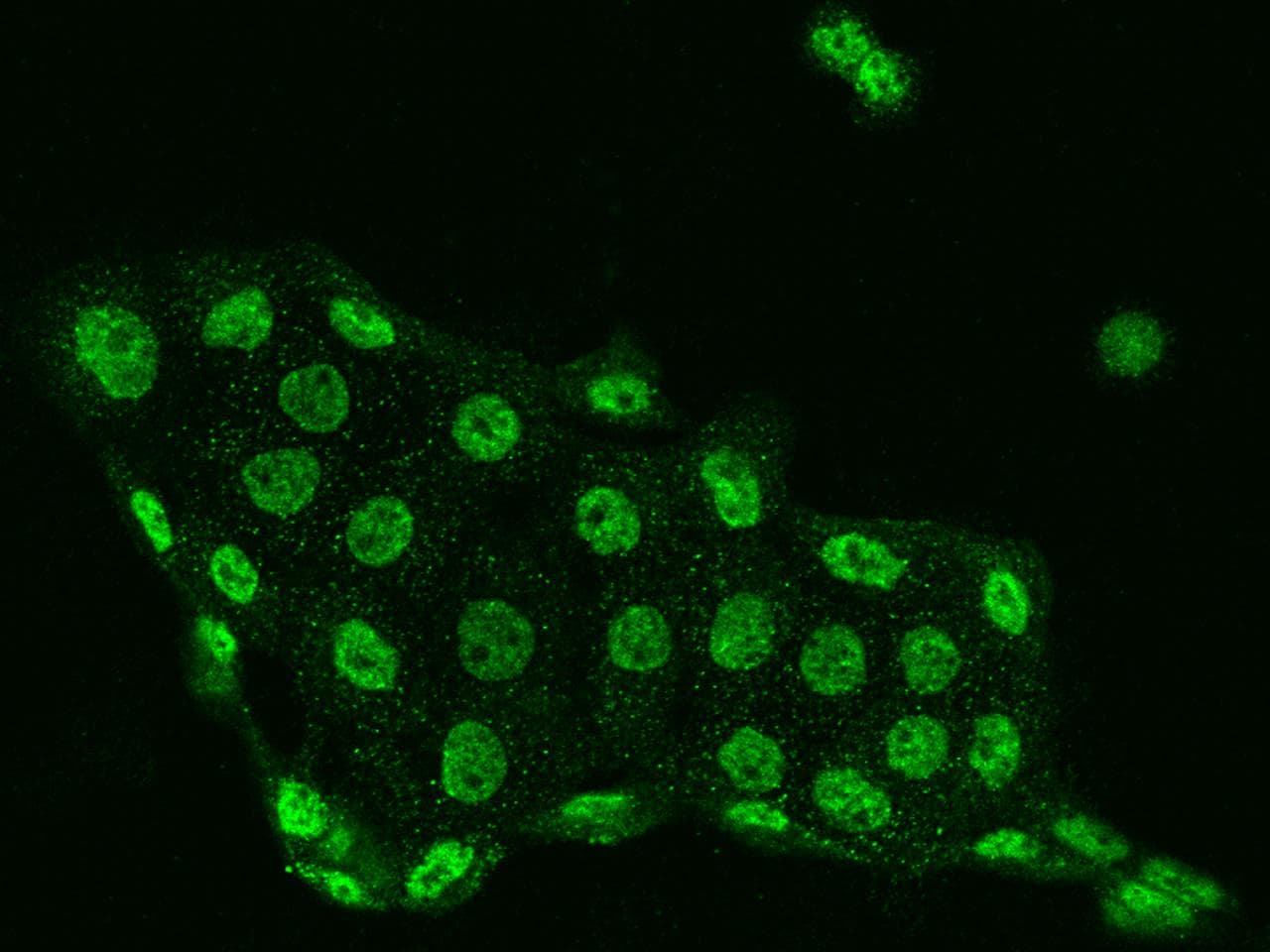 DGK-IOTA / DGKI Antibody