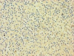 SNCA / Alpha-Synuclein Antibody (aa1-140, HRP)