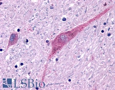 PathPlus™ P2Y13 / P2RY13 Antibody (Cytoplasmic Domain)
