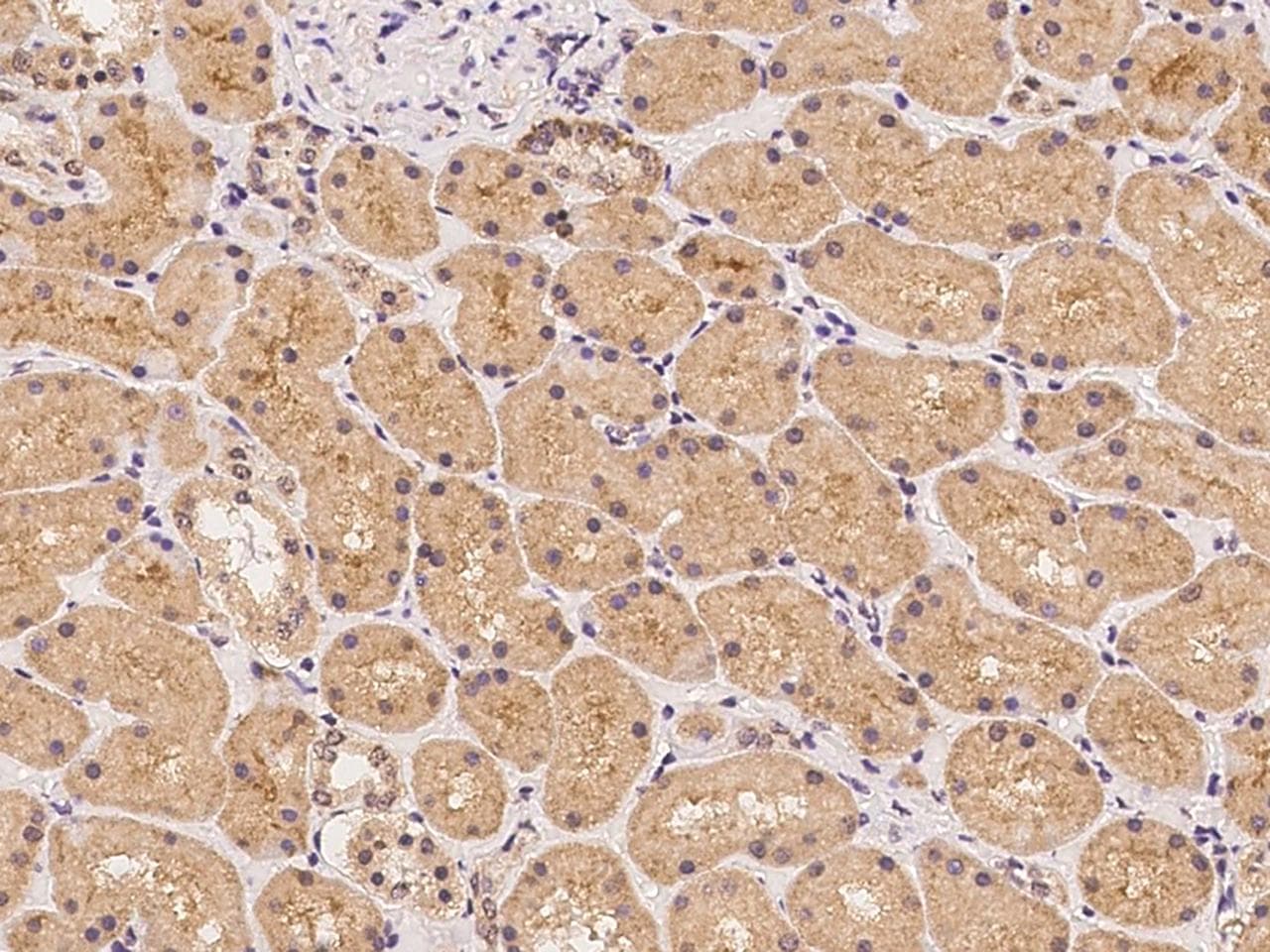LRTM2 Antibody