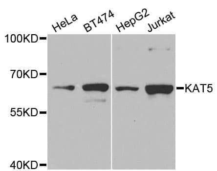 Polyclonal Rabbit anti-Human KAT5 / TIP60 Antibody (IHC, IF, WB)