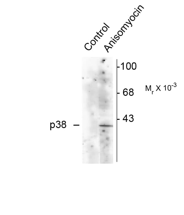 Polyclonal Rabbit anti-Rat MAPK14 / p38 Antibody (phospho-Thr180/Tyr182, IHC, WB)