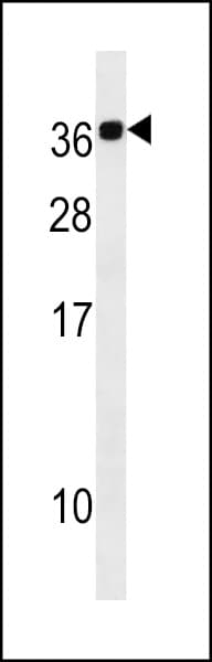 CABP2 Antibody (aa1-30)