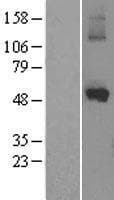 CYP1A1 Protein (Over-Expression Lysate Myc-DDK (Flag))