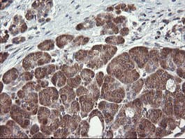 UBE2J1 Antibody (clone OTI1C7)