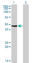IHC-plus™ PAX2 Antibody (clone 3C7)