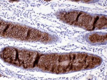 Polyclonal Rabbit anti-Human Mucin 2 / MUC2 Antibody (IHC)