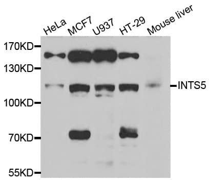 Polyclonal Rabbit anti-Human INTS5 Antibody (IHC, WB)