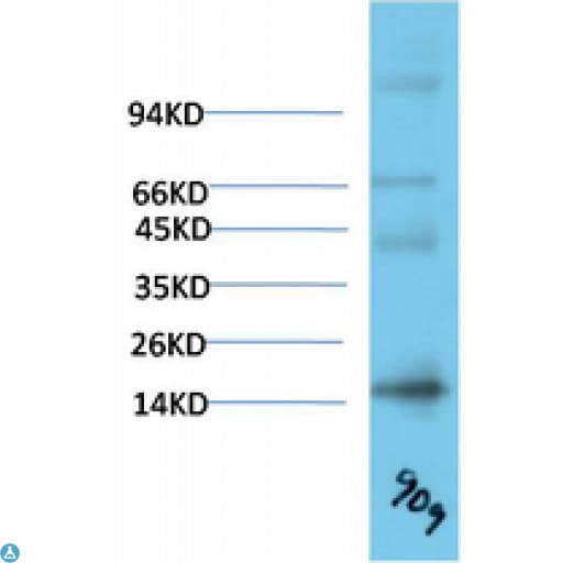TTR / Transthyretin Antibody