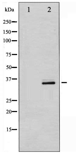 CDK5 Antibody (phospho-Tyr15)