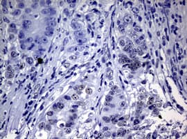 NBN / Nibrin Antibody (aa183-460, clone OTI5E11, Carrier-free)