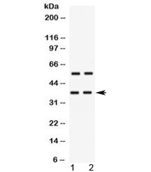 Polyclonal Rabbit anti-Human TREX2 Antibody (WB)