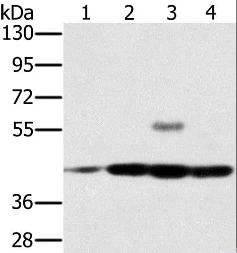 Polyclonal Rabbit anti-Human PAICS / ADE2 Antibody (IHC, WB)