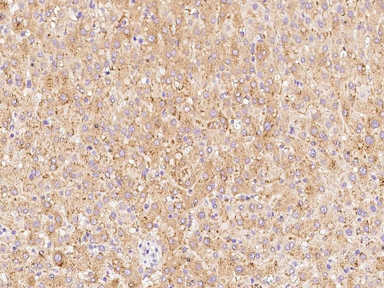 Polyclonal Rabbit anti-Human ALKBH1 / ALKB Antibody (IHC, WB)