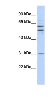 ZNF775 Antibody (N-Terminus)