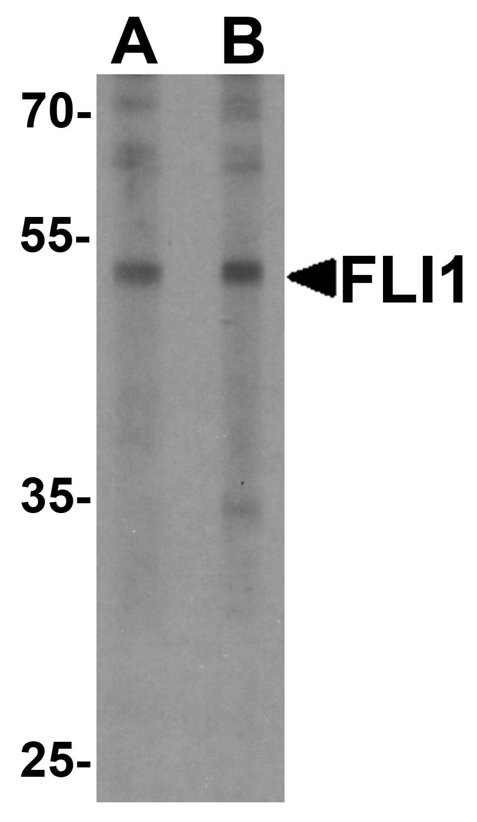 FLI1 Antibody