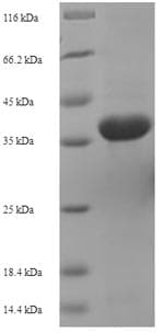Actinoplanes utahensis aac Protein (Recombinant 6His-SUMO, N-terminus)