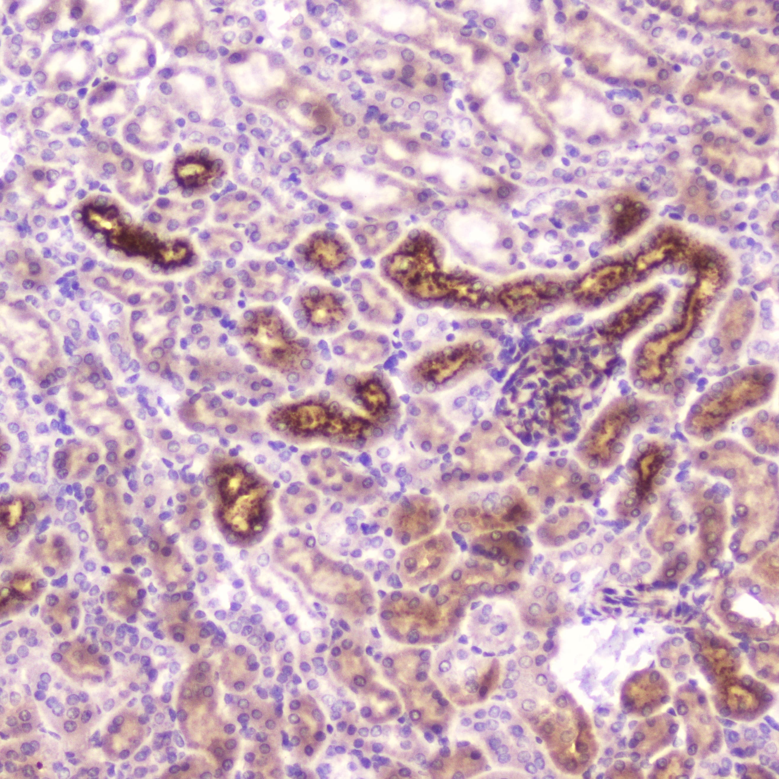 IGFBP2 / IGF-BP53 Antibody