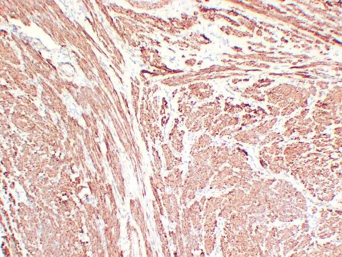 CNN1 / Calponin Antibody (clone ABT-CALP)