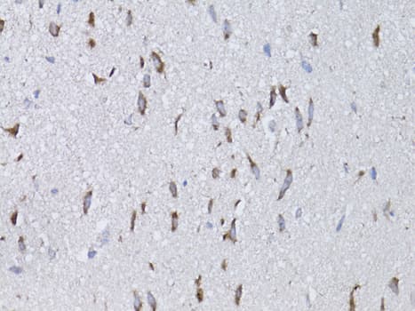 Polyclonal Rabbit anti-Human NGF Antibody (IHC, WB)