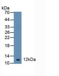 DBI / ACBD1 Antibody (aa1-87, APC)