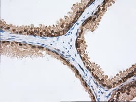 Monoclonal Mouse anti-Human PDE4A / PDE4 Antibody (clone OTI6D6, IHC, IF, WB)