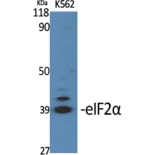 Polyclonal Rabbit anti-Human EIF2S1 Antibody (30-110 aa, IHC, WB)