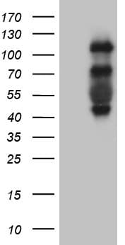 PLK4 / SAK Antibody (aa307-612, clone OTI2D12)