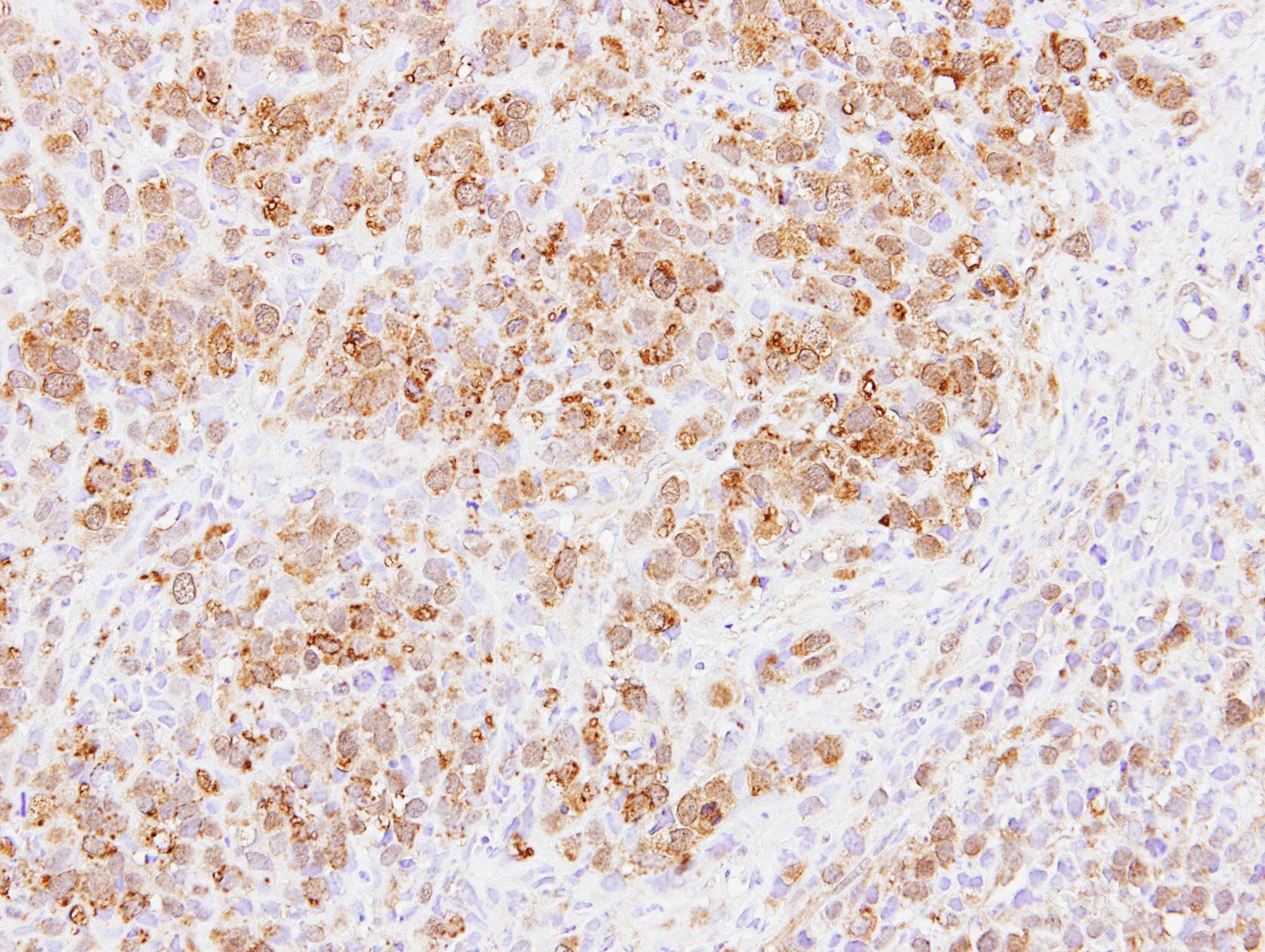 IHC-plus™ Polyclonal Rabbit anti-Human PABPC3 Antibody (aa107-323, IHC, WB)
