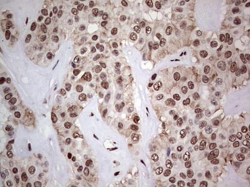 Monoclonal Mouse anti-Human C14orf166 Antibody (clone OTI4A3, IHC, WB)