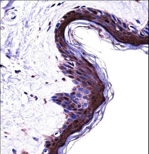 Polyclonal Rabbit anti-Human PSMB5 Antibody (aa235-263, IHC, WB)
